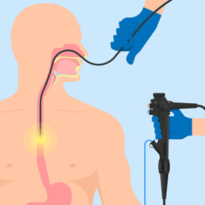 esophageal manometry