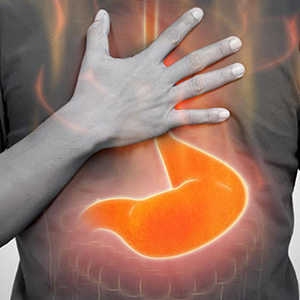 acid reflux stomach